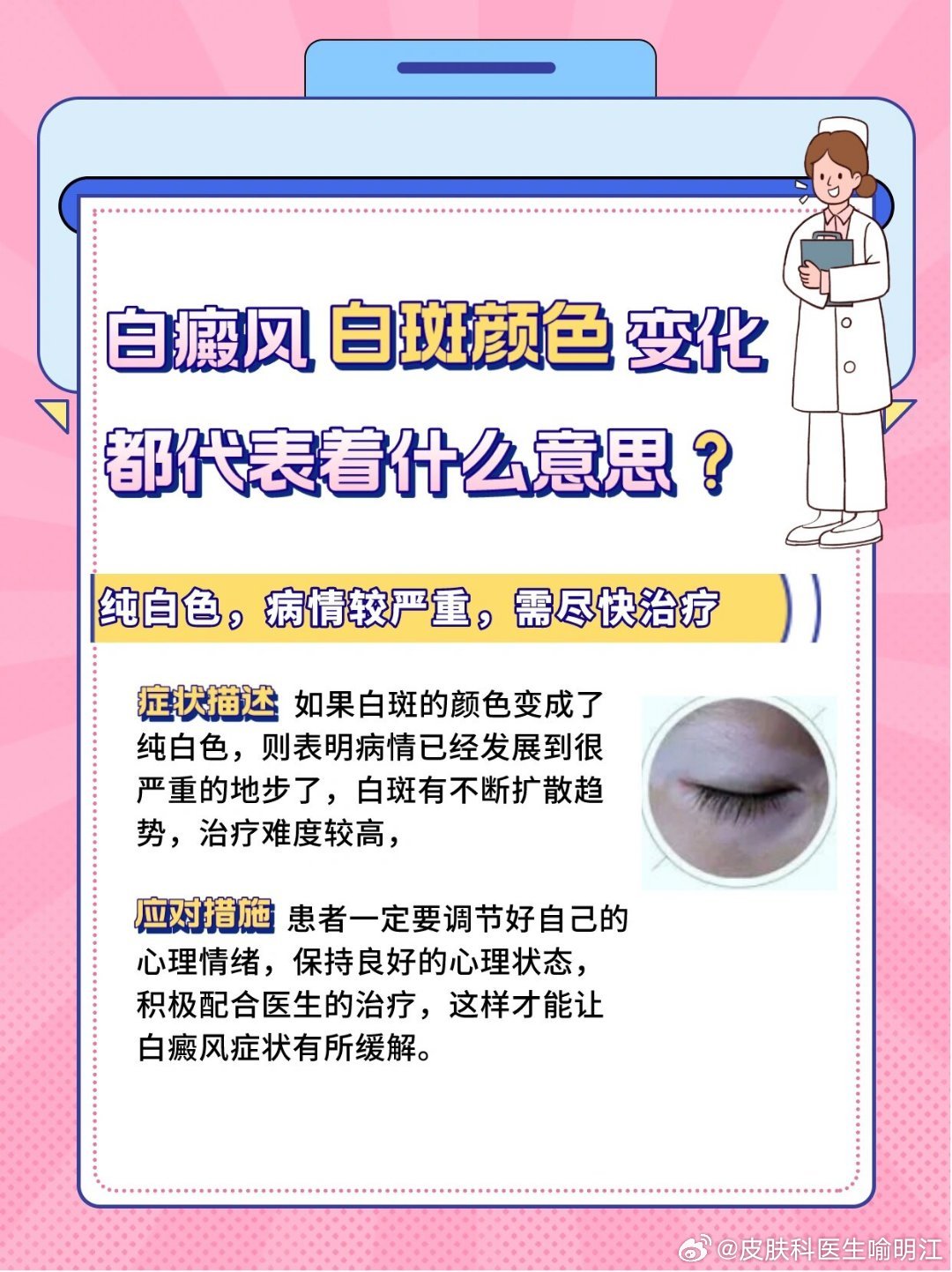 白斑治療新進(jìn)展揭秘,小巷深處的秘密小店探索之路