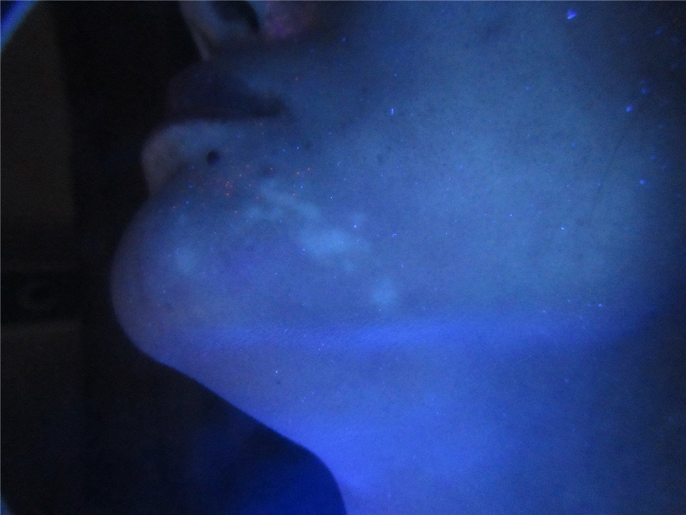 白斑治療新進(jìn)展揭秘,小巷深處的秘密小店探索之路