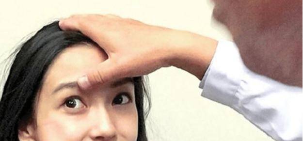 明星換牙，展現變化魅力，自信成就夢想的力量