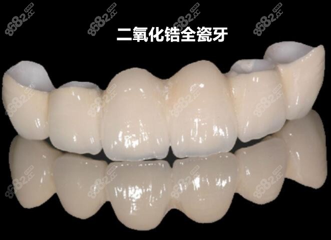 二氧化鋁全瓷牙價格變動與追求自信成就感的關聯探索