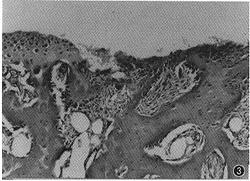 最新沷尼松研究與應用進展的探討