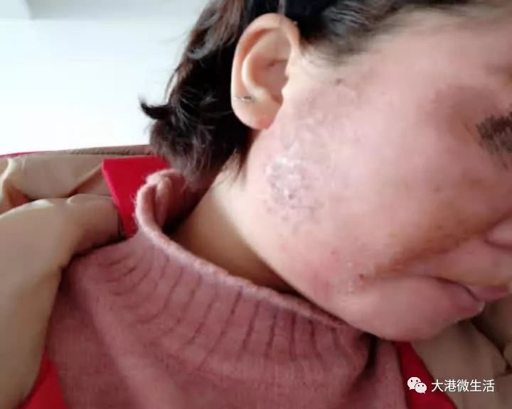 最新寶顏術，探索美容新境界的奧秘